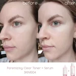 آمپول کوچک‌ کننده منافذ سنتلا SKIN1004